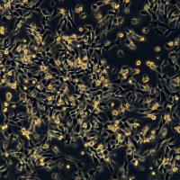 WPMY-1细胞敲除hHIF1A基因细胞株