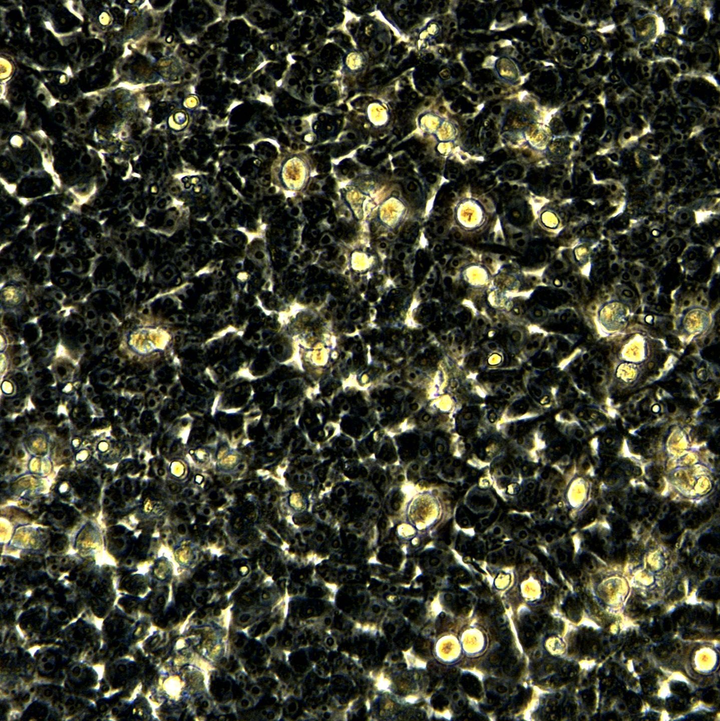 HEK293细胞敲除hUSP11基因细胞系