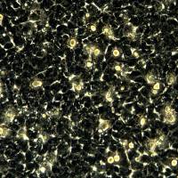 HEK293细胞敲除hUSP11基因细胞系