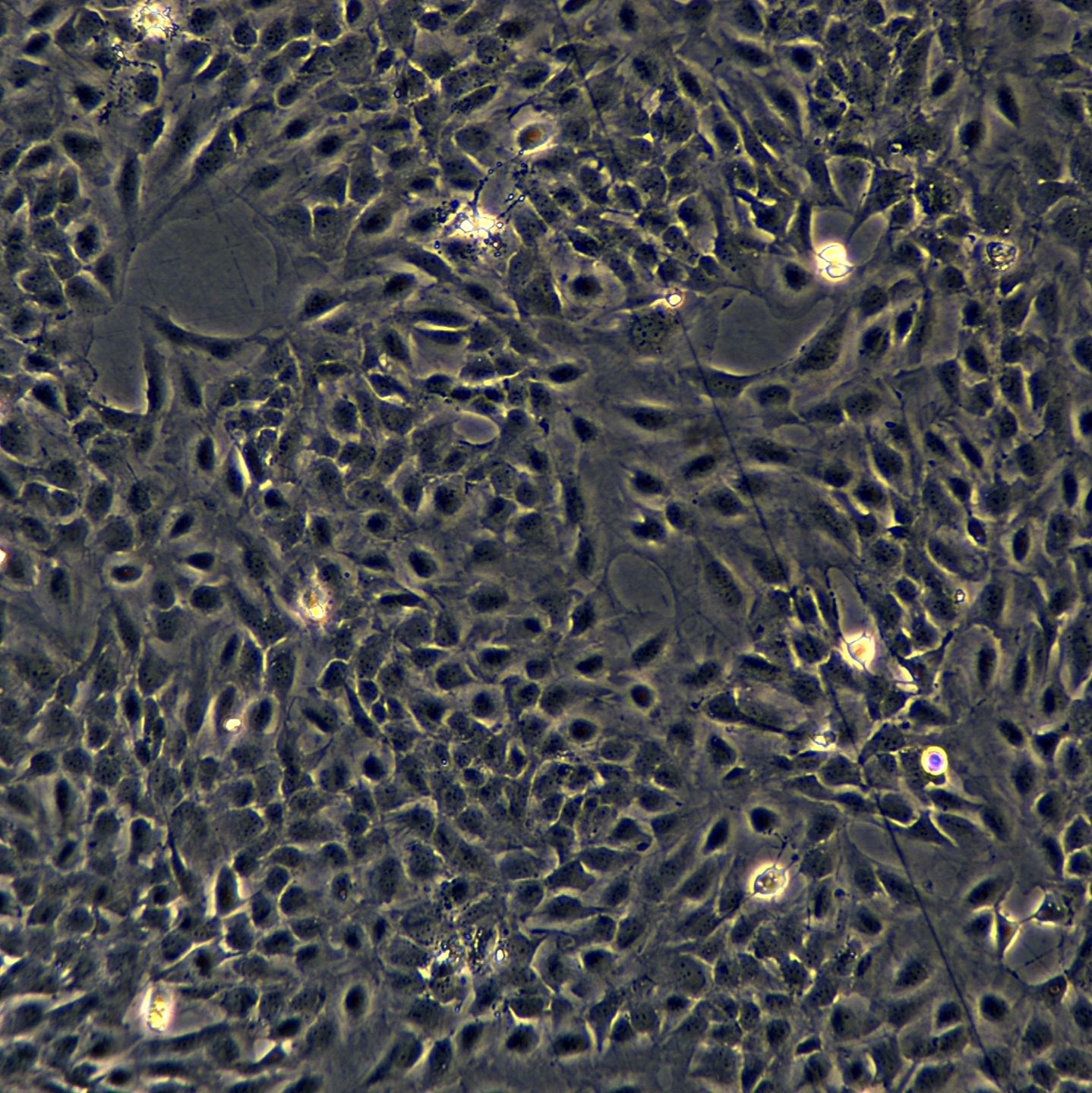BEAS-2B细胞敲除hHIF1A基因细胞株