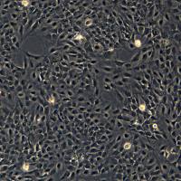 BEAS-2B细胞敲除hHIF1A基因细胞株