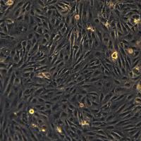 786-O细胞敲除hCBX7基因细胞系