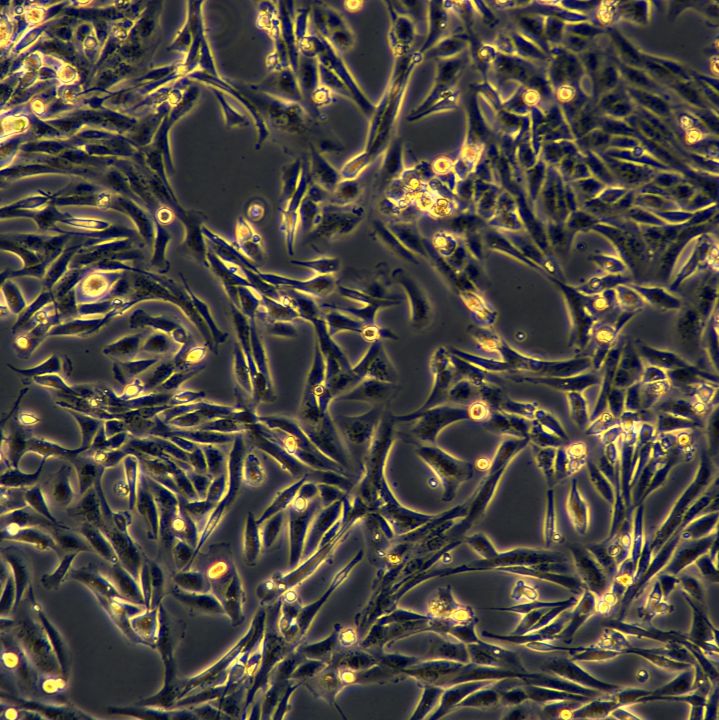 MDA-MB-231细胞敲除hSTK39基因细胞系