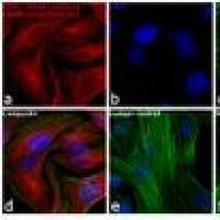 Alexa Fluor 555 A31572 荧光二抗 Donkey anti-Rabbit IgG (H+L) Secondary Antibody