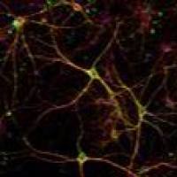 Alexa Fluor 488 荧光二抗A21206 Donkey anti-Rabbit IgG (H+L) Secondary