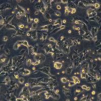 HCC-LM3细胞敲除hUSP22基因细胞系