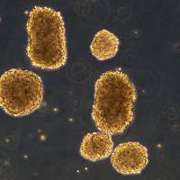 Raji细胞敲除hCD19基因细胞系