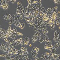 22RV1细胞敲除hFOXA1基因细胞系