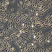 ARPE-19细胞敲除hCYP4V2基因细胞系