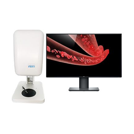 激光散斑血流成像系统