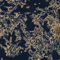 Lncap细胞敲除株hFOXA1基因细胞系