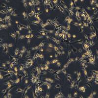 U87-MG细胞敲除hTP53基因细胞系