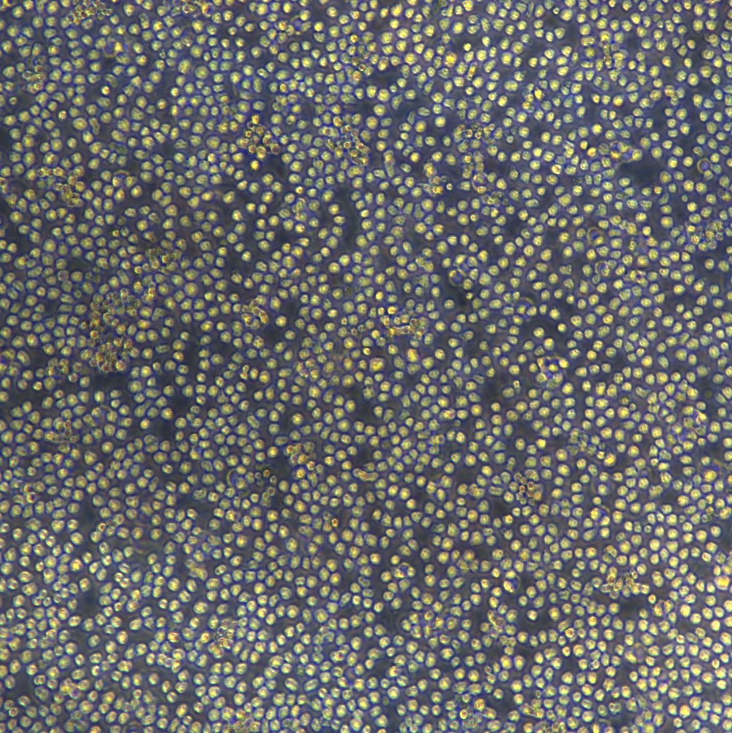 OCI-AML3细胞敲除hFGL2基因细胞系