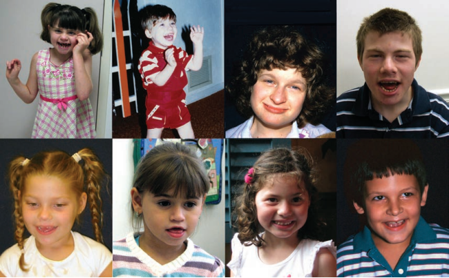 从“快乐假象”到疾病真相：Ube3a基因敲除小鼠揭秘天使综合征的“微笑”之殇