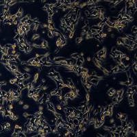 B16细胞敲除mTnfaip8基因细胞系