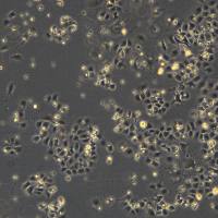 MLE-12细胞敲除mFmr1基因细胞株