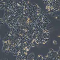 HCC-LM3细胞敲除hGIHCG基因细胞株