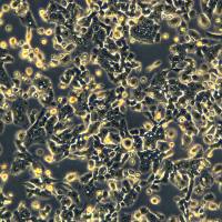 AsPC-1细胞敲除hCDH17基因细胞系