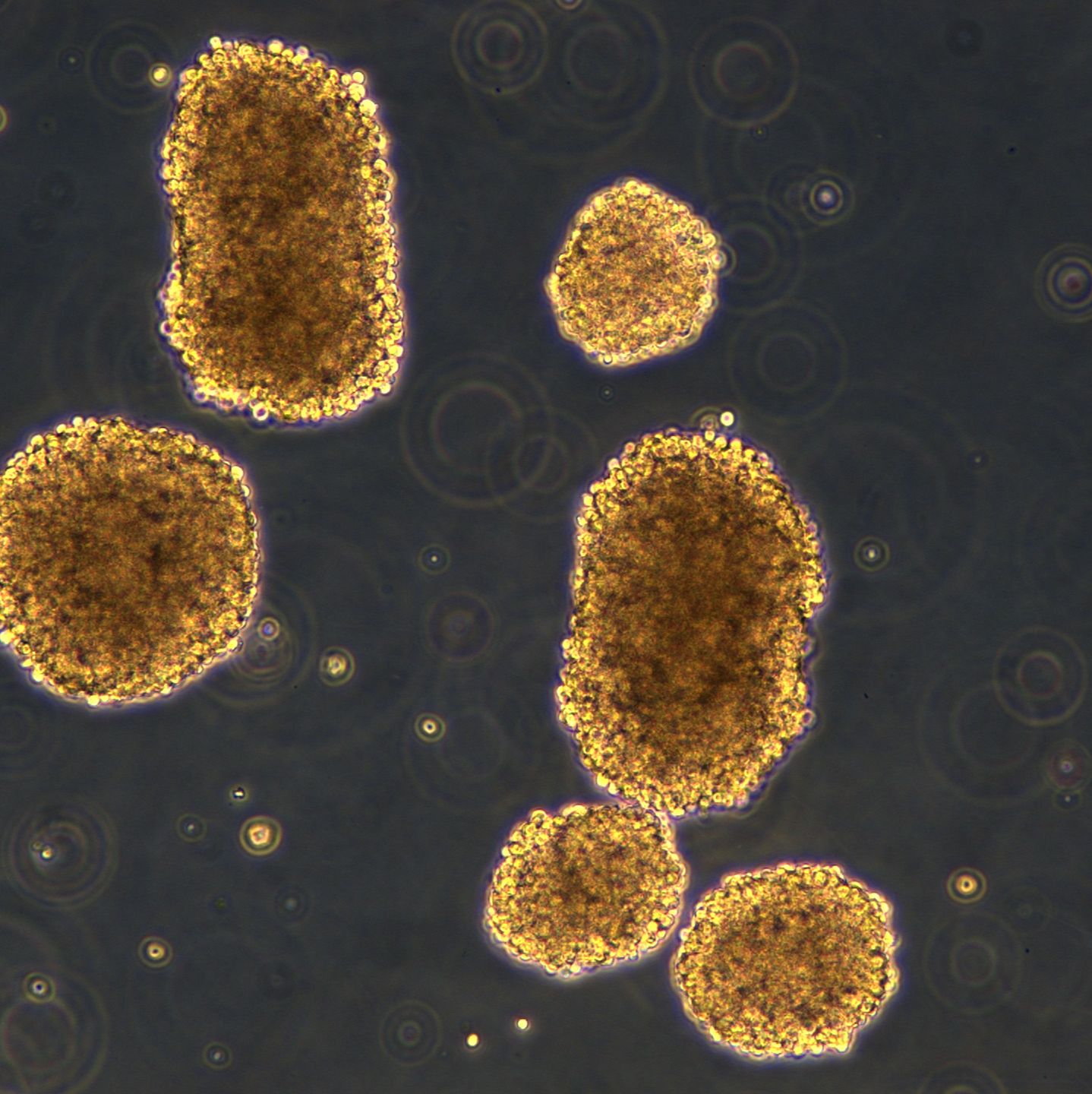 Raji细胞敲除hCMTM6基因细胞系