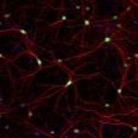 Alexa Fluor 594 荧光二抗 A21207 Donkey anti-Rabbit