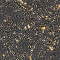 U-87 MG细胞敲除hFGL2基因细胞系