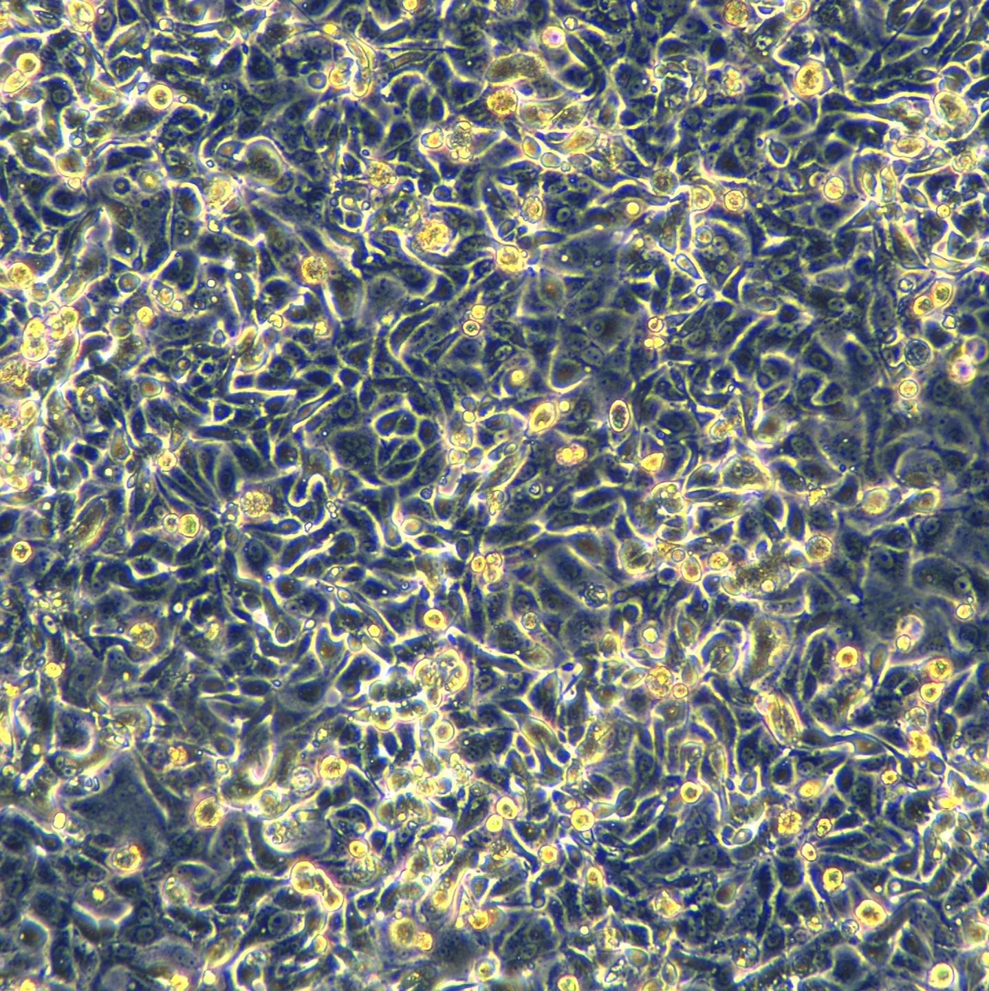MCF-7细胞敲除hINSR基因细胞系