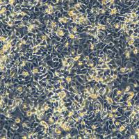 MCF-7细胞敲除hINSR基因细胞系