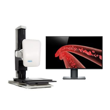 激光散斑血流成像系统LSI BFI系列