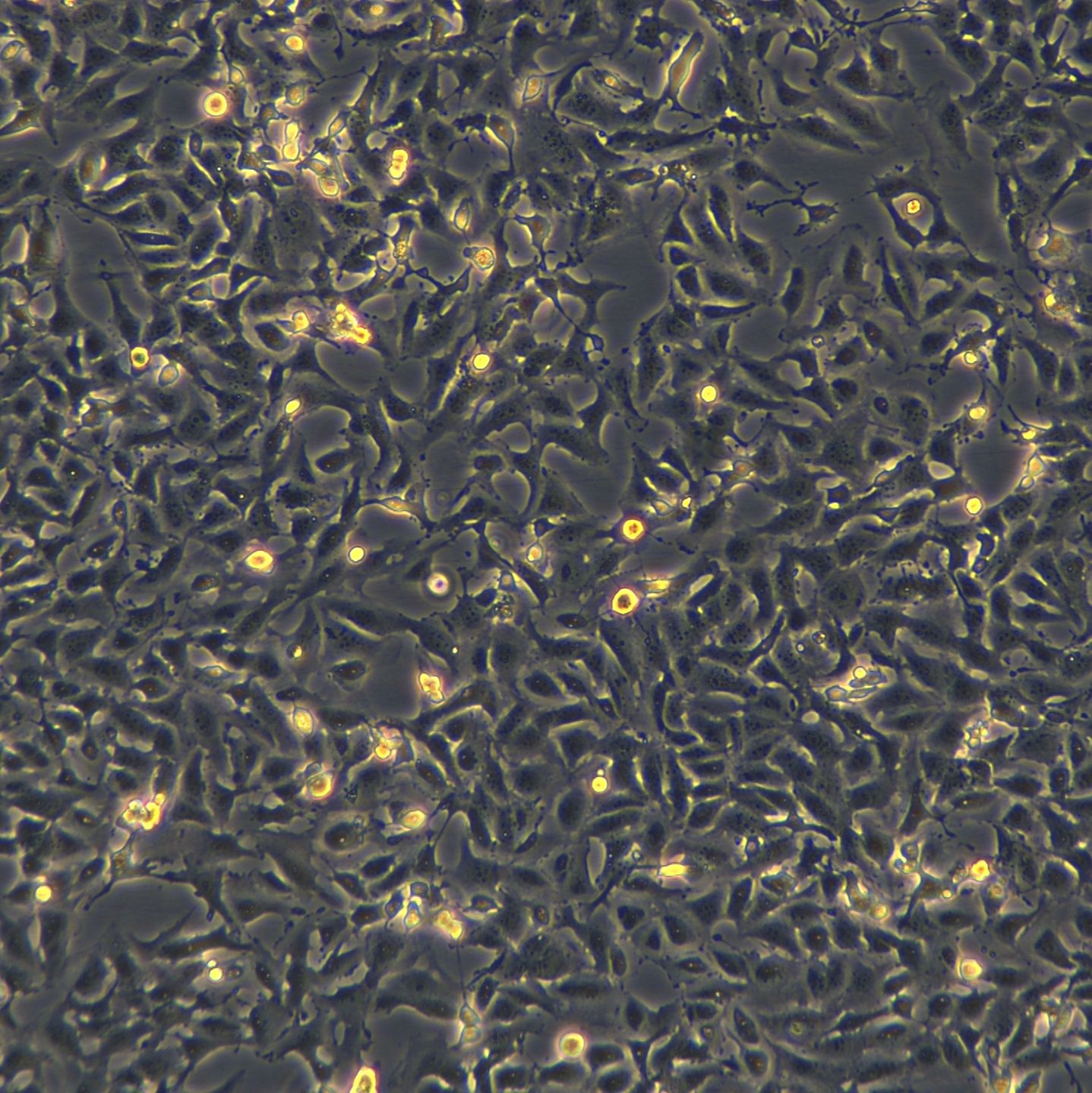 B-CPAP细胞敲除hSLC5A5基因细胞株