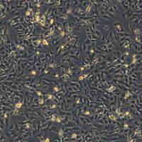 B-CPAP细胞敲除hSLC5A5基因细胞株