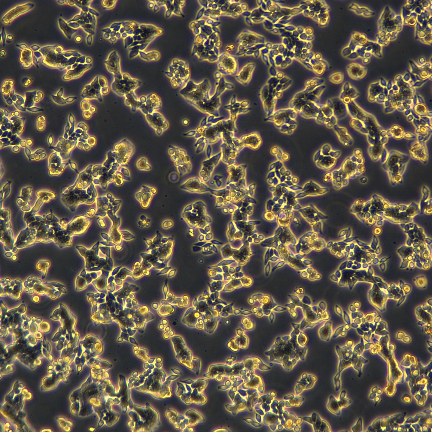 SW620细胞敲除hHKDC1基因细胞株
