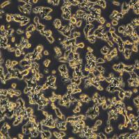 SW620细胞敲除hHKDC1基因细胞株