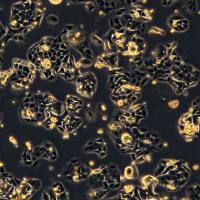 SW480细胞敲除hSERPINB2基因细胞株