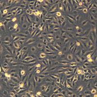 Daoy细胞敲除SUFU基因细胞系