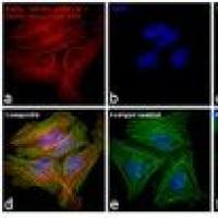 Alexa Fluor 594 A11032 Goat anti-Mouse IgG (H+L) Highly Cross-Adsorbed Secondary Antibody