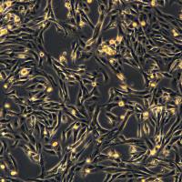 MDA-MB-231细胞敲除hHACD2基因细胞系