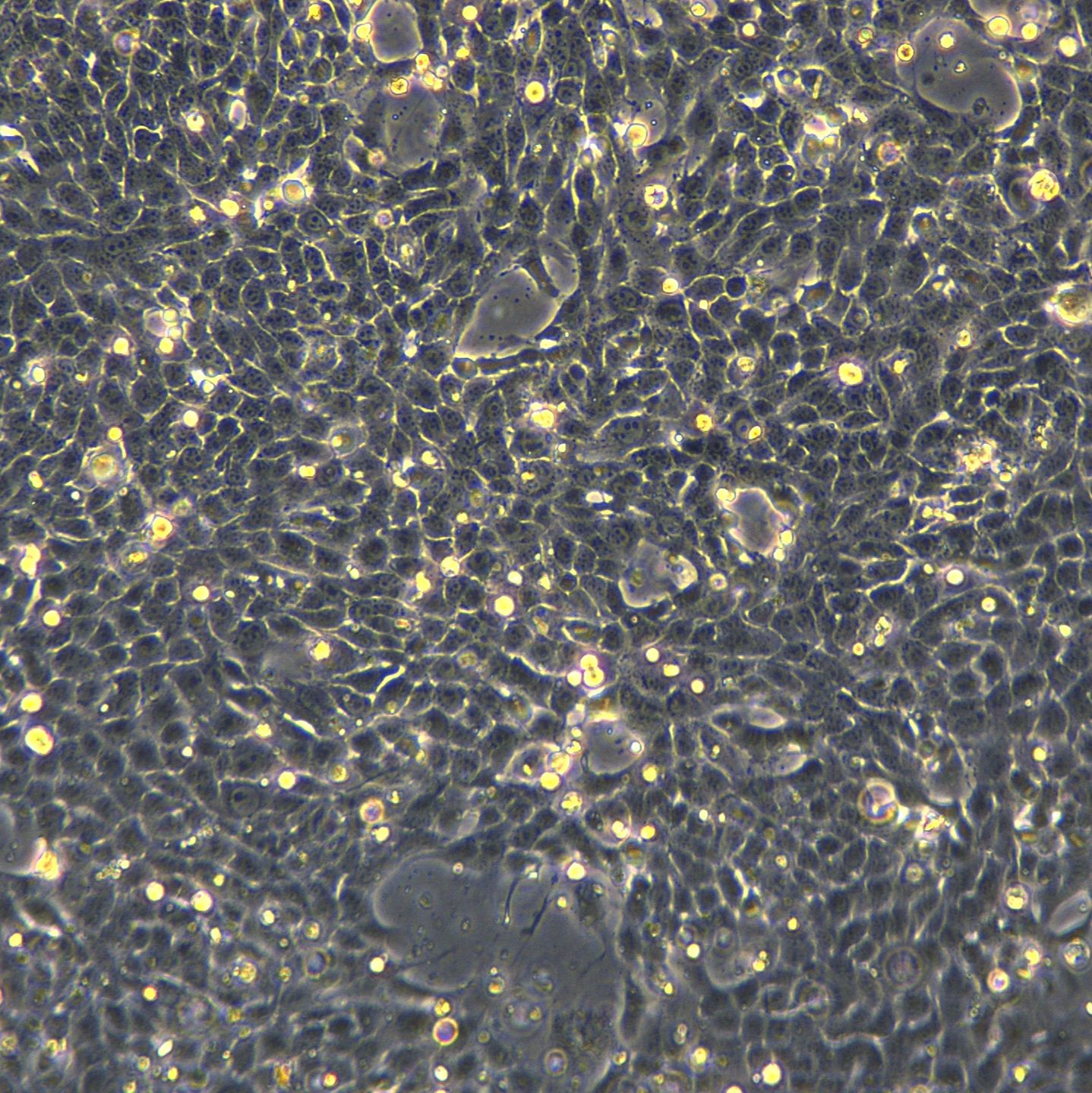 4T1细胞敲除Ythdf1基因细胞系