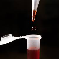 IgM Fc5mu / Immunoglobulin M, Fc5mu