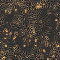 SiHa细胞敲除human YTHDF3基因细胞系