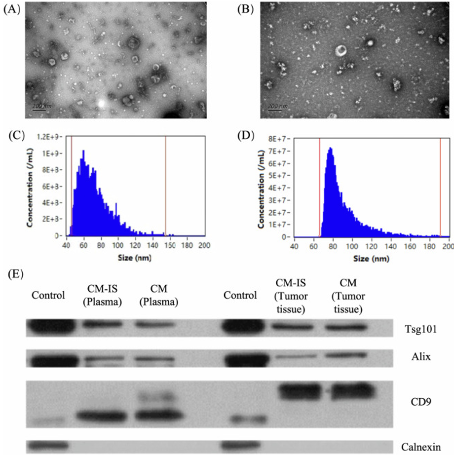 划重点！6篇论文助你高效完成外泌体分离！