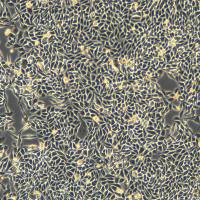 RKO细胞敲除POLQ基因细胞系