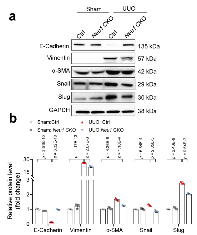 【AAV在肾脏疾病中的应用】IF=17.69│中国药科大学齐炼文教授/张蕾研究员团队揭示肾纤维化治疗新靶点及相关机制