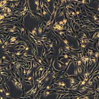 MDA-MB-231细胞敲除hMIR301A基因细胞株