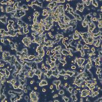 Min6细胞敲除Npc1基因细胞系