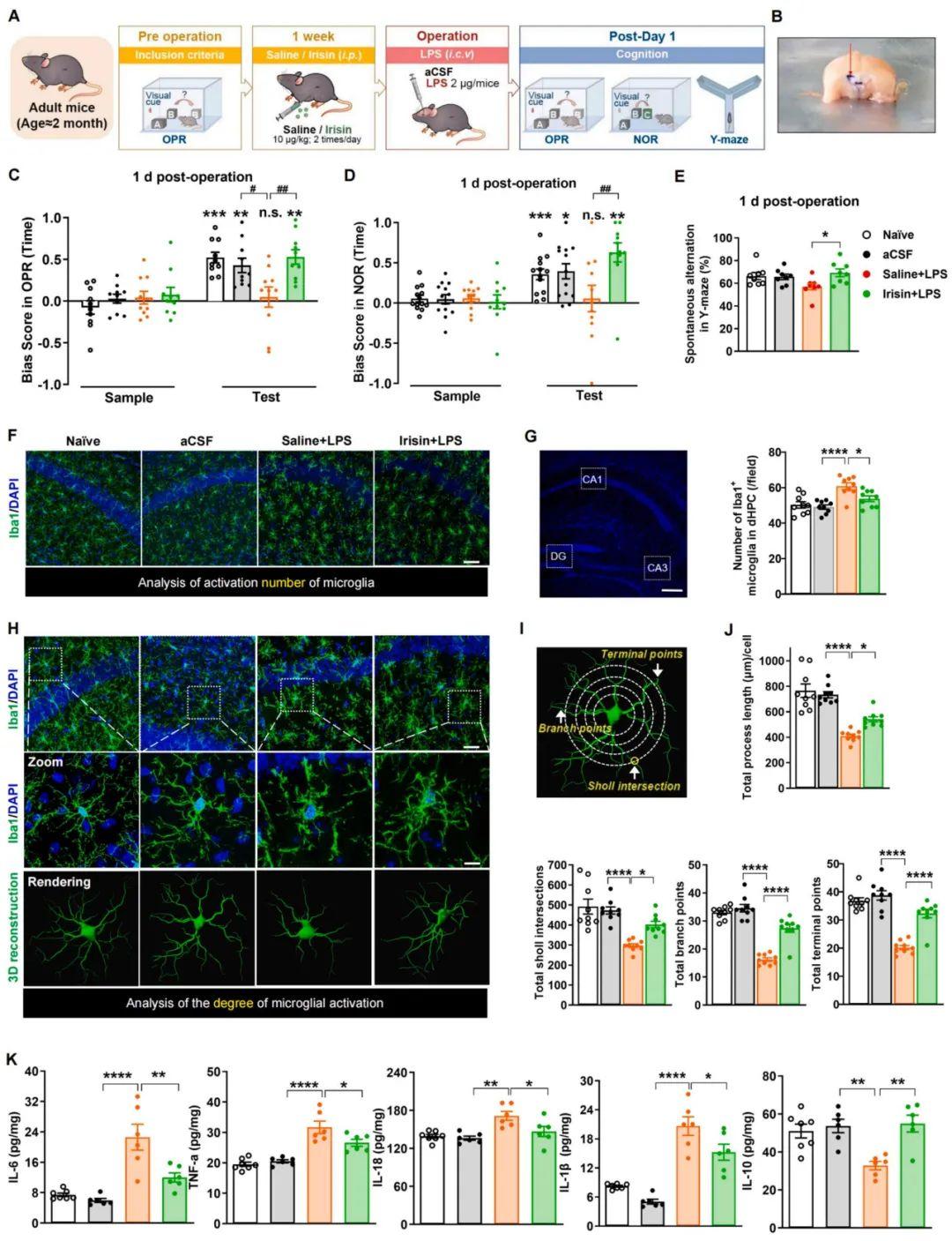 【慢病毒应用客户文章】北京大学神经科学研究所万有教授团队揭示鸢尾素通过激活STAT6重编程小胶质细胞预防术后认知功能障碍的新机制