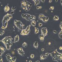 NCIN87细胞敲除hSOX9 基因细胞系