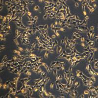 B16-F10细胞敲除mRipk1基因细胞系