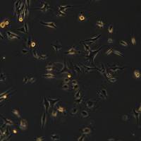 bEnd.3细胞敲除mCdh5基因细胞系