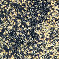 NCI-H1299细胞敲除hG6PD基因细胞系