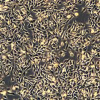 HGC-27细胞敲除hHKDC1基因细胞系